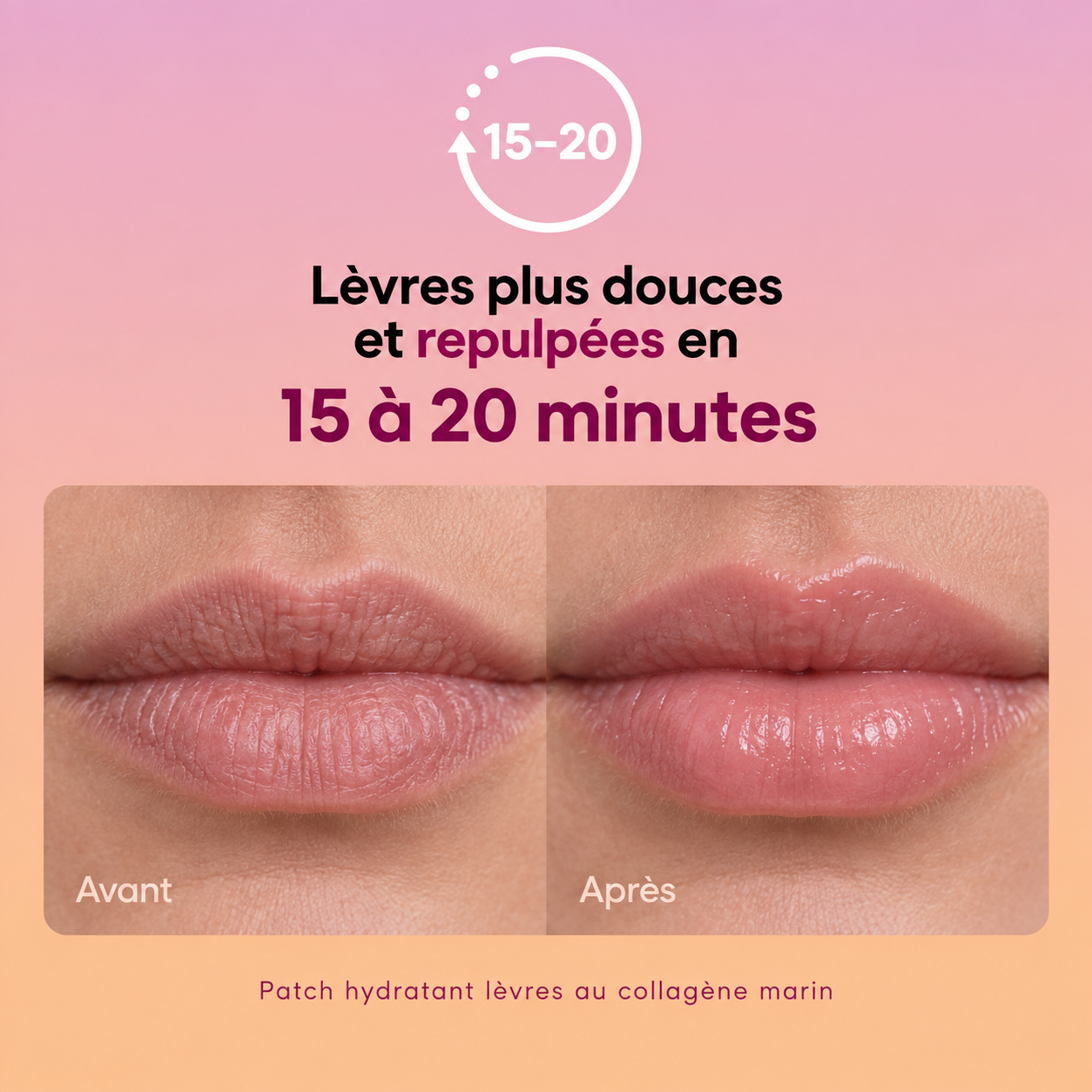 Écume - Patch Hydratant lèvres