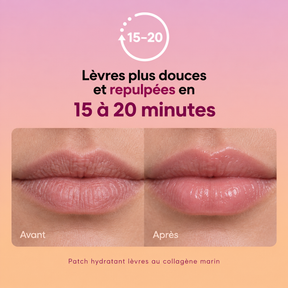 Écume - Patch Hydratant lèvres